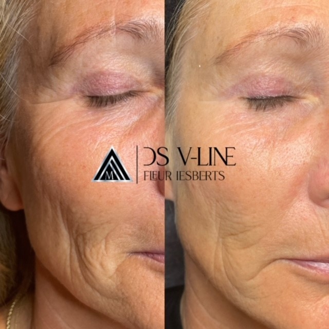 Huidinstituut Schoonheidssalon Beauty Academy SenZ